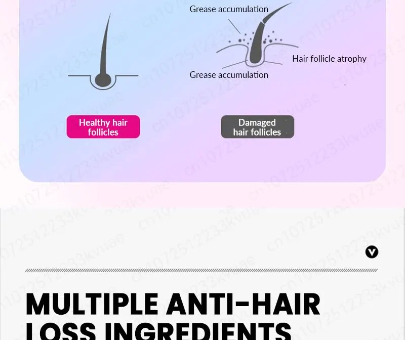 Hair growth essential oil. Effectively repairs baldness and hair loss symptoms, suitable for both men and women Hair growth essential oil. Effectively repairs baldness and hair loss symptoms, suitable for both men and women