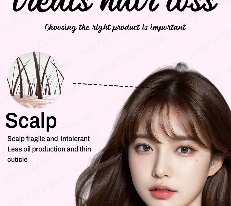 Hair growth essential oil. Effectively repairs baldness and hair loss symptoms, suitable for both men and women Hair growth essential oil. Effectively repairs baldness and hair loss symptoms, suitable for both men and women