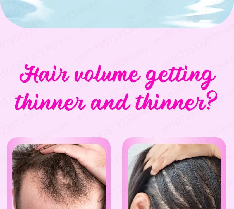 Hair growth essential oil. Effectively repairs baldness and hair loss symptoms, suitable for both men and women Hair growth essential oil. Effectively repairs baldness and hair loss symptoms, suitable for both men and women