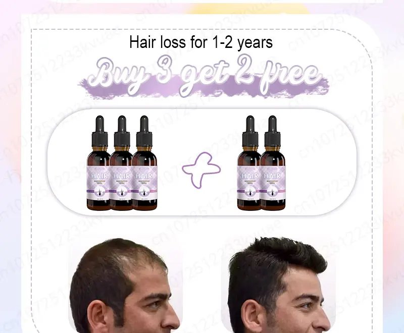 Hair growth essential oil. Effectively repairs baldness and hair loss symptoms, suitable for both men and women Hair growth essential oil. Effectively repairs baldness and hair loss symptoms, suitable for both men and women