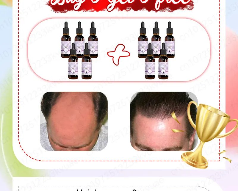 Hair growth essential oil. Effectively repairs baldness and hair loss symptoms, suitable for both men and women Hair growth essential oil. Effectively repairs baldness and hair loss symptoms, suitable for both men and women