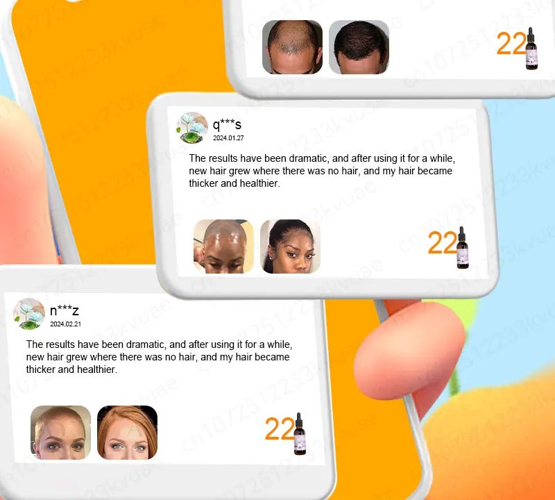 Hair growth essential oil. Effectively repairs baldness and hair loss symptoms, suitable for both men and women Hair growth essential oil. Effectively repairs baldness and hair loss symptoms, suitable for both men and women