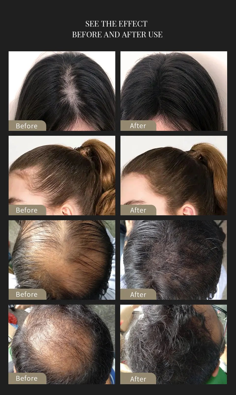 Sevich Hair Building Fibers Powder Spray Keratin Thicker Anti Hair Loss Products Instant Hair Growth Fiber Hair Care Christmas Sevich Hair Building Fibers Powder Spray Keratin Thicker Anti Hair Loss Products Instant Hair Growth Fiber Hair Care Christmas