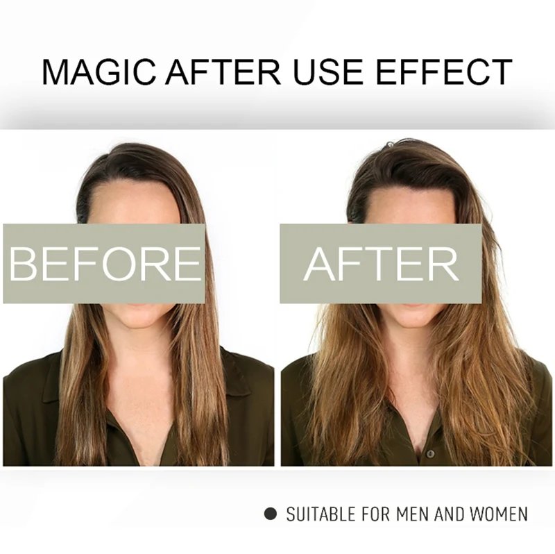 Sevich Hair Building Fibers Powder Spray Keratin Thicker Anti Hair Loss Products Instant Hair Growth Fiber Hair Care Christmas Sevich Hair Building Fibers Powder Spray Keratin Thicker Anti Hair Loss Products Instant Hair Growth Fiber Hair Care Christmas