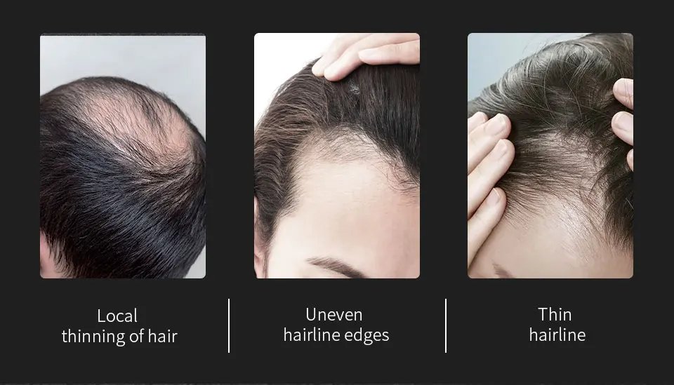 Sevich Hair Building Fibers Powder Spray Keratin Thicker Anti Hair Loss Products Instant Hair Growth Fiber Hair Care Christmas Sevich Hair Building Fibers Powder Spray Keratin Thicker Anti Hair Loss Products Instant Hair Growth Fiber Hair Care Christmas