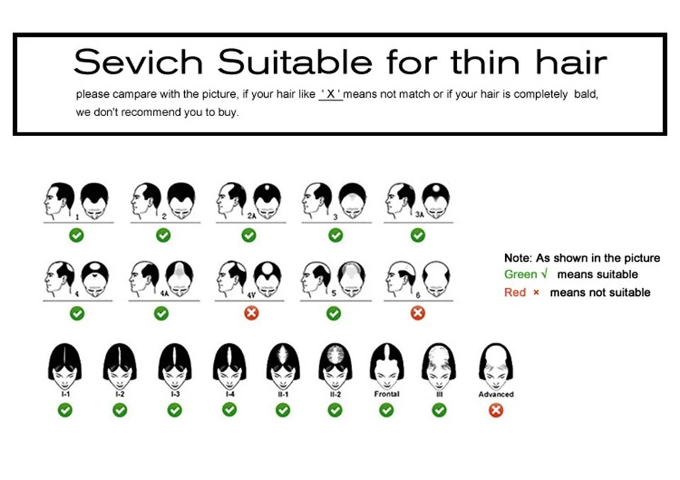 Sevich Hair Building Fibers Powder Spray Keratin Thicker Anti Hair Loss Products Instant Hair Growth Fiber Hair Care Christmas Sevich Hair Building Fibers Powder Spray Keratin Thicker Anti Hair Loss Products Instant Hair Growth Fiber Hair Care Christmas