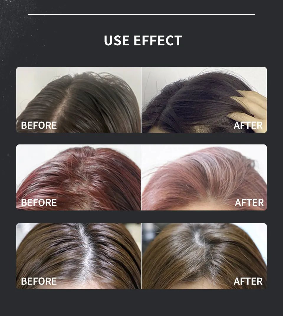 Sevich Hair Building Fibers Powder Spray Keratin Thicker Anti Hair Loss Products Instant Hair Growth Fiber Hair Care Christmas Sevich Hair Building Fibers Powder Spray Keratin Thicker Anti Hair Loss Products Instant Hair Growth Fiber Hair Care Christmas