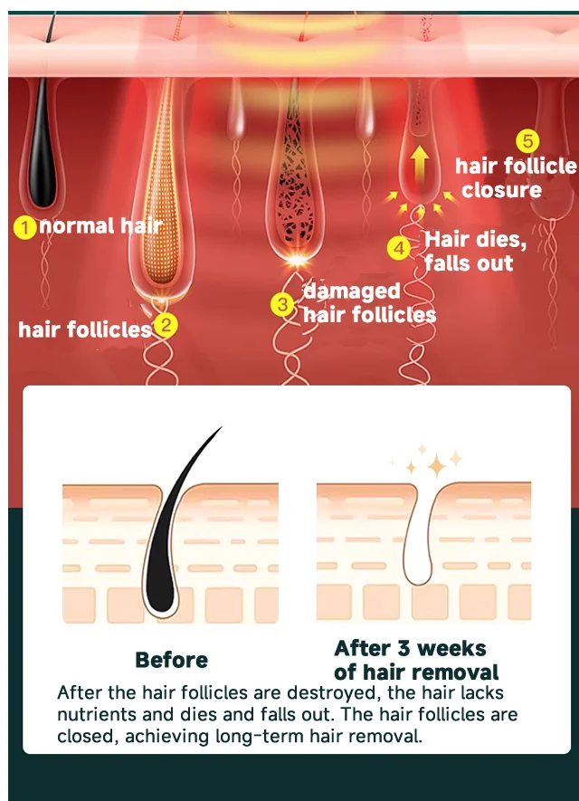 Professional Women Laser Hair Removal IPL Epilator Female Pulsed Light Electric Depilatory Device For Facial Body Bikini Professional Women Laser Hair Removal IPL Epilator Female Pulsed Light Electric Depilatory Device For Facial Body Bikini