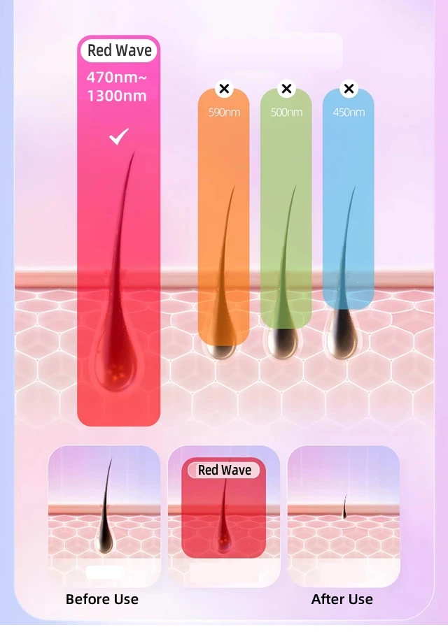 Professional Women Laser Hair Removal IPL Epilator Female Pulsed Light Electric Depilatory Device For Facial Body Bikini Professional Women Laser Hair Removal IPL Epilator Female Pulsed Light Electric Depilatory Device For Facial Body Bikini