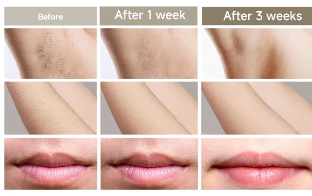 Professional Women Laser Hair Removal IPL Epilator Female Pulsed Light Electric Depilatory Device For Facial Body Bikini Professional Women Laser Hair Removal IPL Epilator Female Pulsed Light Electric Depilatory Device For Facial Body Bikini