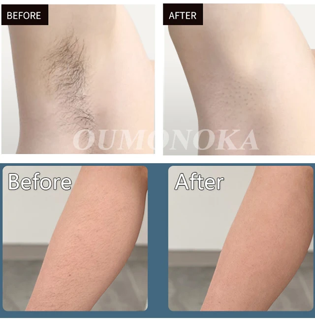 Professional Women Laser Hair Removal IPL Epilator Female Pulsed Light Electric Depilatory Device For Facial Body Bikini Professional Women Laser Hair Removal IPL Epilator Female Pulsed Light Electric Depilatory Device For Facial Body Bikini