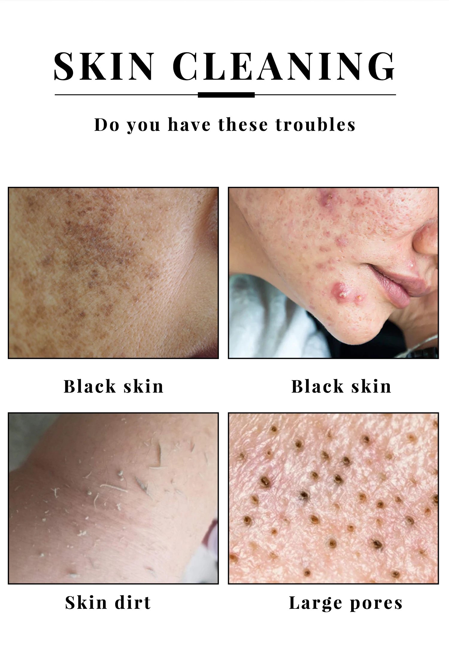 Kojic Acid Glow Soap Facial Deep Cleaning Even Skin Tone Skin Lightening Soap Oil Control Moisturizing Skin Care 65g x2