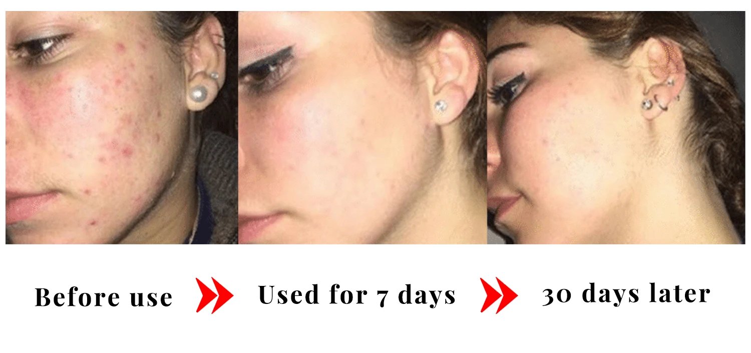 Kojic Acid Glow Soap Facial Deep Cleaning Even Skin Tone Skin Lightening Soap Oil Control Moisturizing Skin Care 65g x2