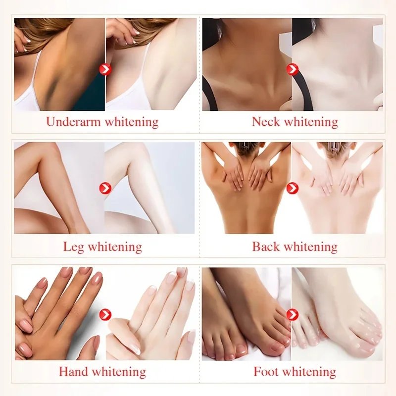 Body Whitening Soap Deep Clean Skin Chicken Skin Removal Soap Armpit Underarm Knees Bleaching Body Brighten White Care Products