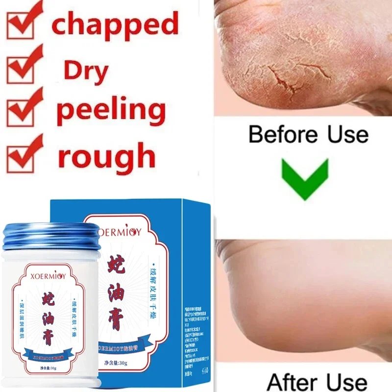 30g Moisturizing Anti-Drying Crack Foot Cream Hand Feet Care Family Exfoliation Dead Skin Removal Softening Smooth Skin Cream