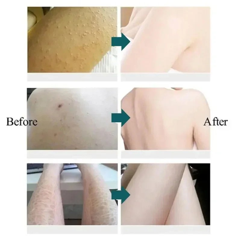 30g Moisturizing Anti-Drying Crack Foot Cream Hand Feet Care Family Exfoliation Dead Skin Removal Softening Smooth Skin Cream