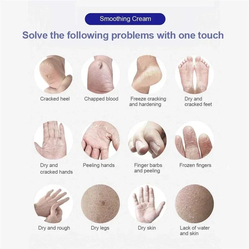 30g Moisturizing Anti-Drying Crack Foot Cream Hand Feet Care Family Exfoliation Dead Skin Removal Softening Smooth Skin Cream