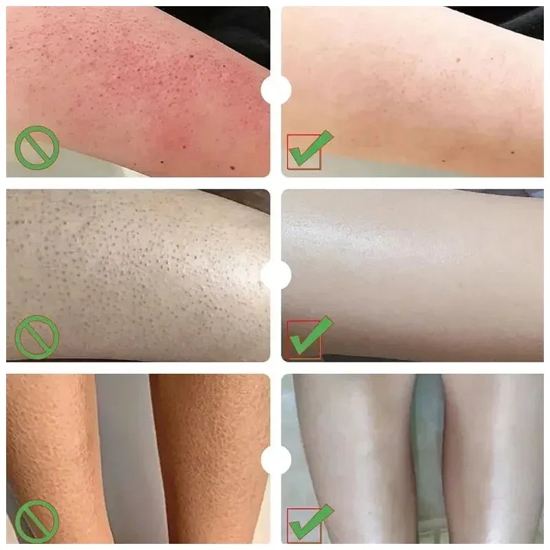 30g Moisturizing Anti-Drying Crack Foot Cream Hand Feet Care Family Exfoliation Dead Skin Removal Softening Smooth Skin Cream