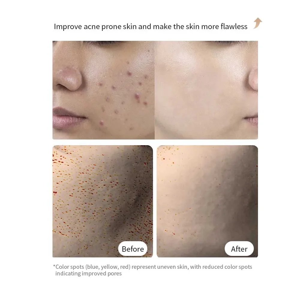 7 Colours LED Light Mask Rechargeable LED Mask Skin Care Home Use Red Light Therapy Photon Devices Face Beauty Facial Devices 7 Colours LED Light Mask Rechargeable LED Mask Skin Care Home Use Red Light Therapy Photon Devices Face Beauty Facial Devices