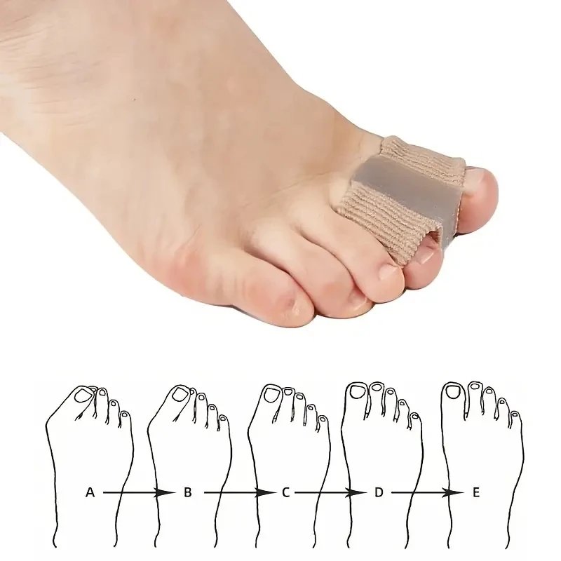 1 Pairs Toe Separator Hallux Valgus Corrector Toe Spacer Spreader Fat Finger Corrector Thumb Bunion Straightener Foot Care Tool