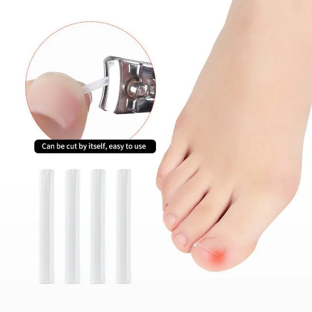 50Pc/box Ingrown Toenail Correction Tool Ingrown Toe Nail Treatment Elastic Patch Sticker Straightening Clip Brace Pedicure Tool 50Pc/box Ingrown Toenail Correction Tool Ingrown Toe Nail Treatment Elastic Patch Sticker Straightening Clip Brace Pedicure Tool