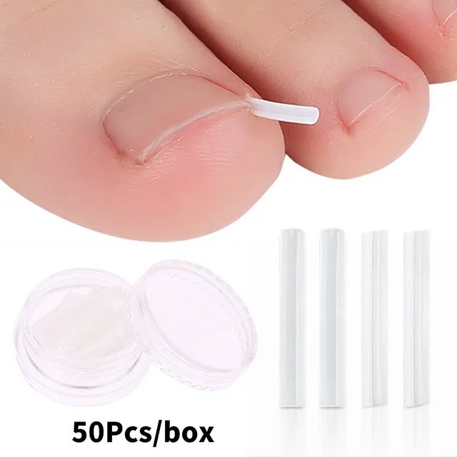 50Pc/box Ingrown Toenail Correction Tool Ingrown Toe Nail Treatment Elastic Patch Sticker Straightening Clip Brace Pedicure Tool 50Pc/box Ingrown Toenail Correction Tool Ingrown Toe Nail Treatment Elastic Patch Sticker Straightening Clip Brace Pedicure Tool