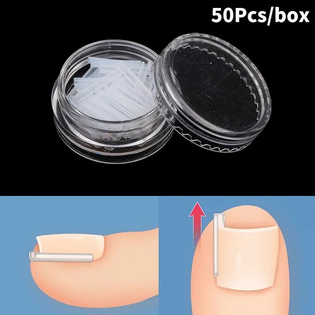 50Pc/box Ingrown Toenail Correction Tool Ingrown Toe Nail Treatment Elastic Patch Sticker Straightening Clip Brace Pedicure Tool 50Pc/box Ingrown Toenail Correction Tool Ingrown Toe Nail Treatment Elastic Patch Sticker Straightening Clip Brace Pedicure Tool