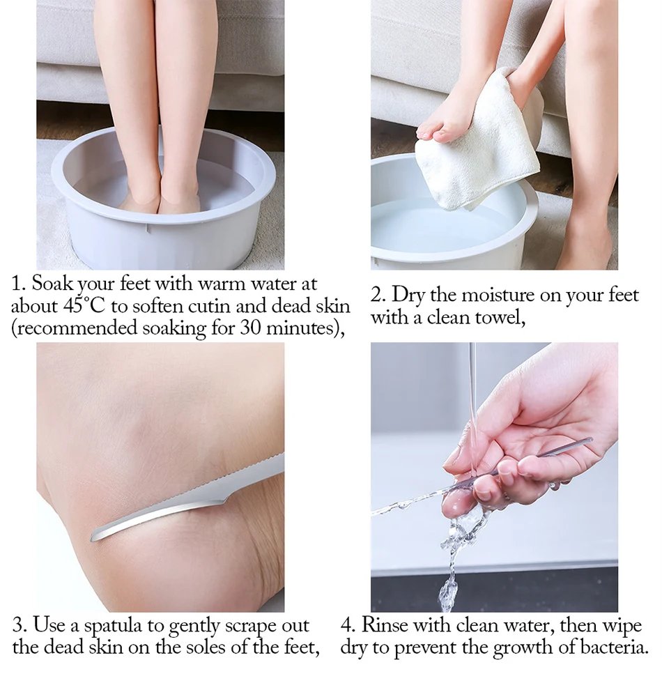 Pedicure Knife Tools for Feet Stainless Steel Foot Scrubber Dead Skin Remover 1/2/5Pcs Foot Scraper Knife Scraping Manicure Tool Pedicure Knife Tools for Feet Stainless Steel Foot Scrubber Dead Skin Remover 1/2/5Pcs Foot Scraper Knife Scraping Manicure Tool