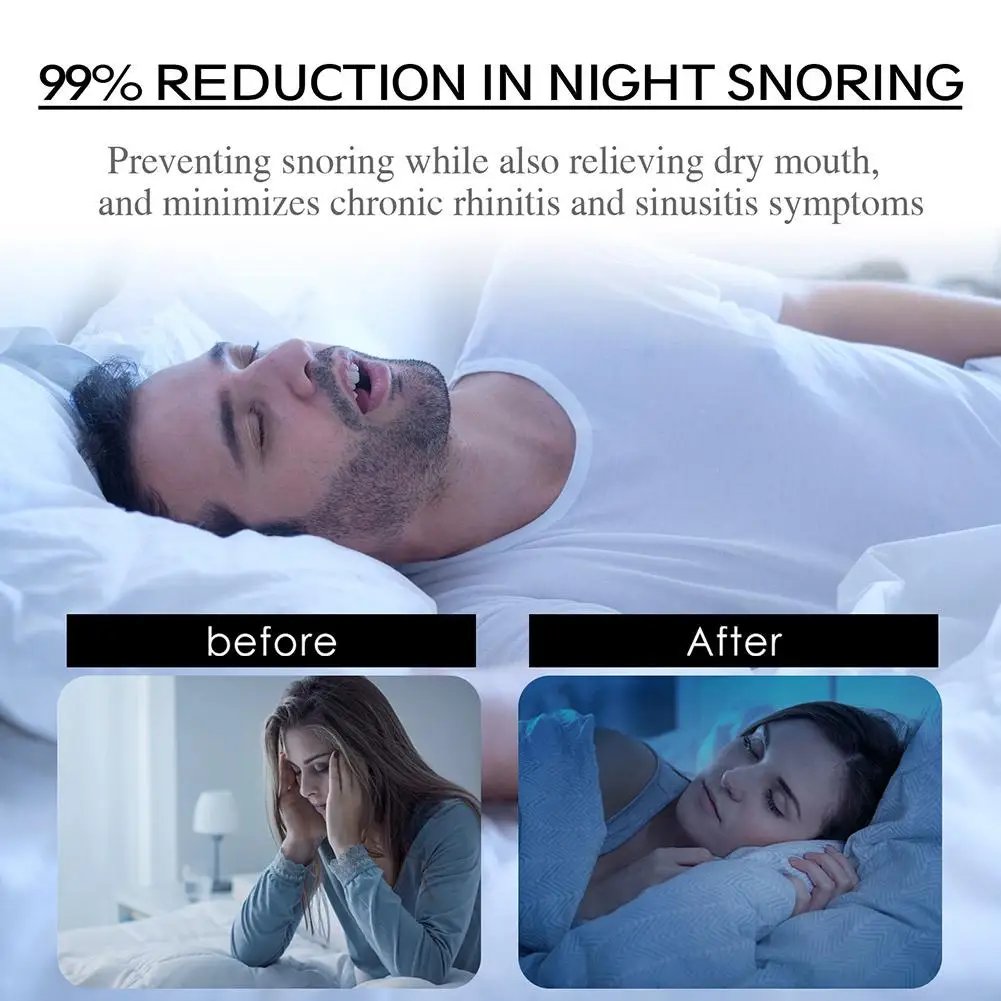 Stop Snoring Patch Nose Breathing Improvement Patch Refresh Lungs Relieve Pain Improve Sleeping Night Sleep Mouth Tape 30pcs