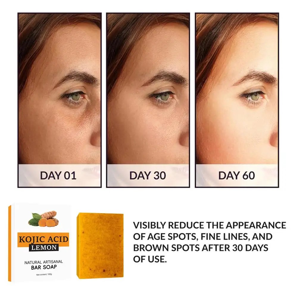 Turmeric Soap Face Cleansing Anti Acne Whitening Skin Lightening Face Remove Pimples Lightening Ginger Handmade Soap