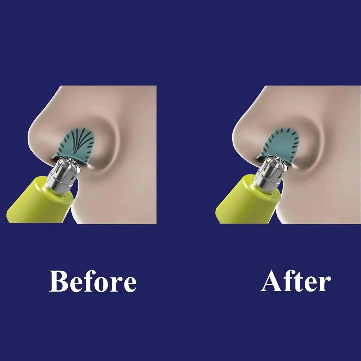 Electric Trimmer Shaver Replacement Kit for OneBlade Compatible with QP2520 QP2530 QP2630 QP6510 QP6520 QP2523 - New Model